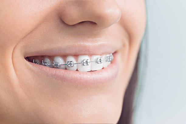 Best Full Mouth Reconstruction  in Clawson, MI